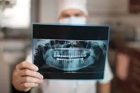 radiografía panorámica dental 